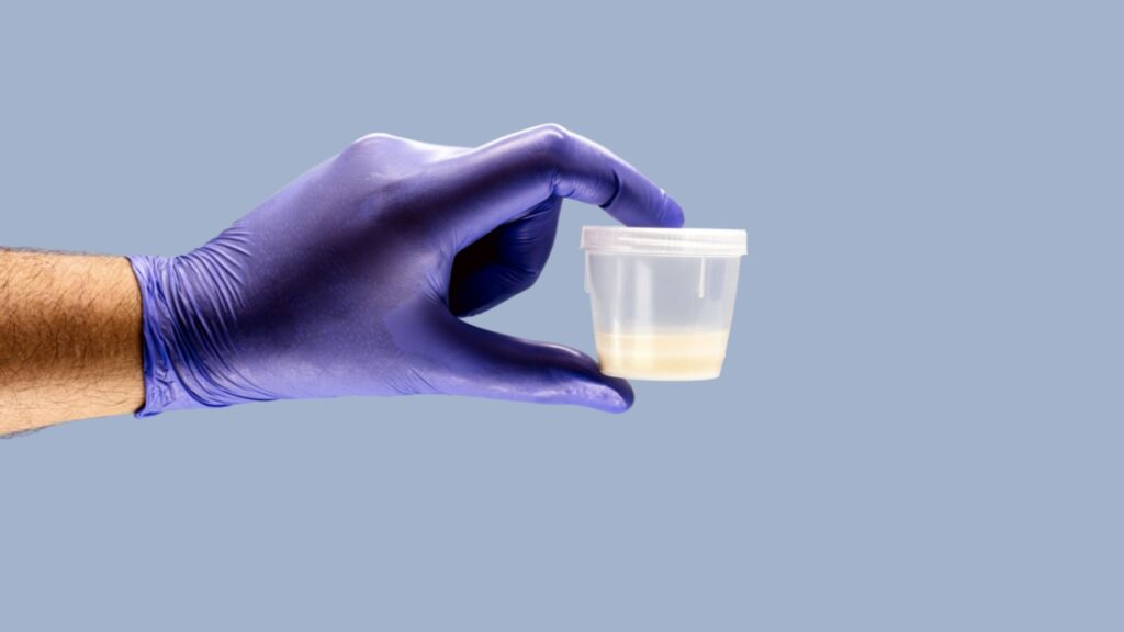 Entenda como funciona o espermograma e o congelamento de sêmen