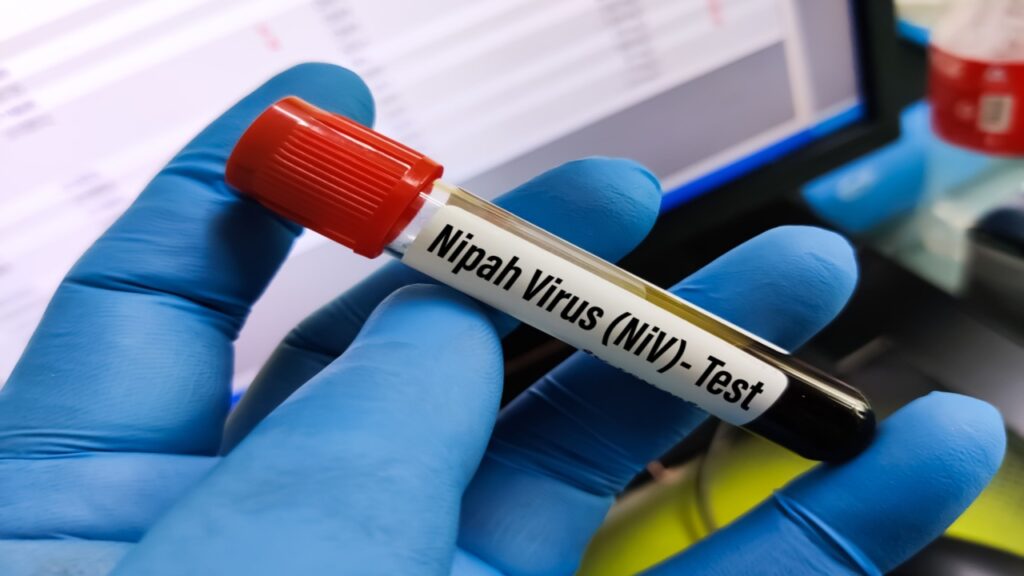 Letal e com alto poder de epidemia: entenda o que é o vírus Nipah