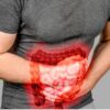 Conheça os sintomas e as causas de obstrução intestinal